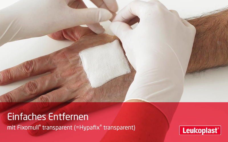 Dieses Video demonstriert die Eignung von Fixomull® transparent als wasserdichte Fixierung von Wundauflagen, die das Duschen ermöglicht: Sie sehen einen Patienten, der sich mit dem Produkt auf der Hand die Hände wäscht. Anschließend entfernt das Fachpersonal die Fixierung einfach und hautfreundlich.   Dieses Video demonstriert die Eignung von Fixomull® transparent als wasserdichte Fixierung von Wundauflagen, die das Duschen ermöglicht: Sie sehen einen Patienten, der sich mit dem Produkt auf der Hand die Hände wäscht. Anschließend entfernt das Fachpersonal die Fixierung einfach und hautfreundlich.